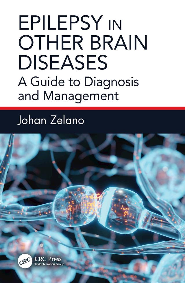 Epilepsy in Other Brain Diseases by Johan Zelano