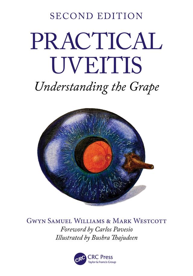 Practical Uveitis by Gwyn Samuel Williams, Mark Westcott