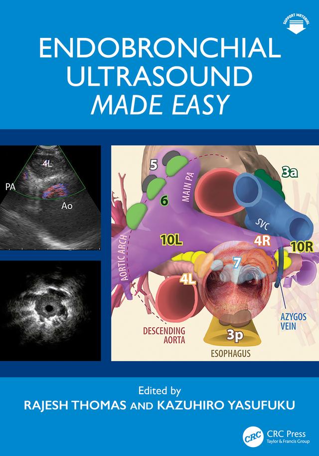 Endobronchial Ultrasound Made Easy by Kazuhiro Yasufuku, Rajesh Thomas