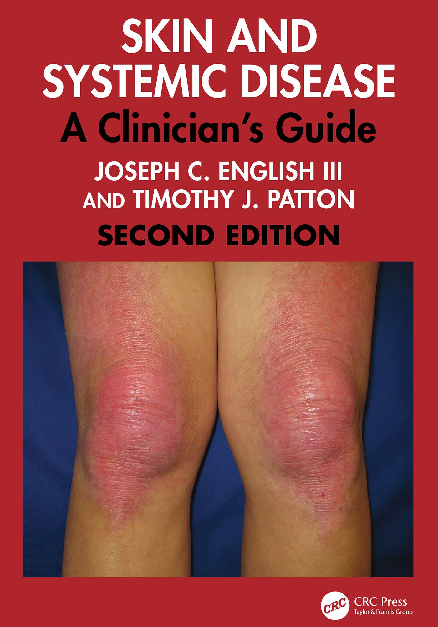 Skin and Systemic Disease