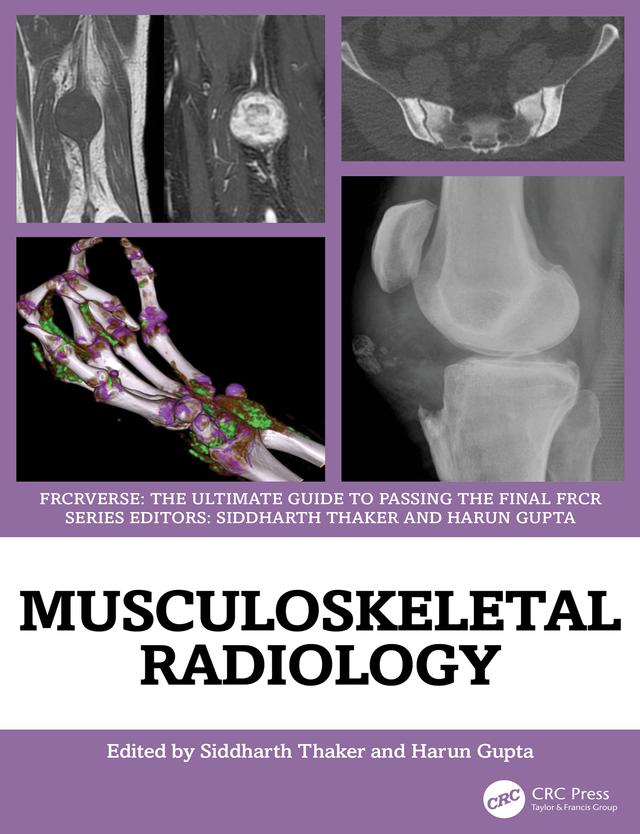 Musculoskeletal Radiology by Harun Gupta, Siddharth Thaker
