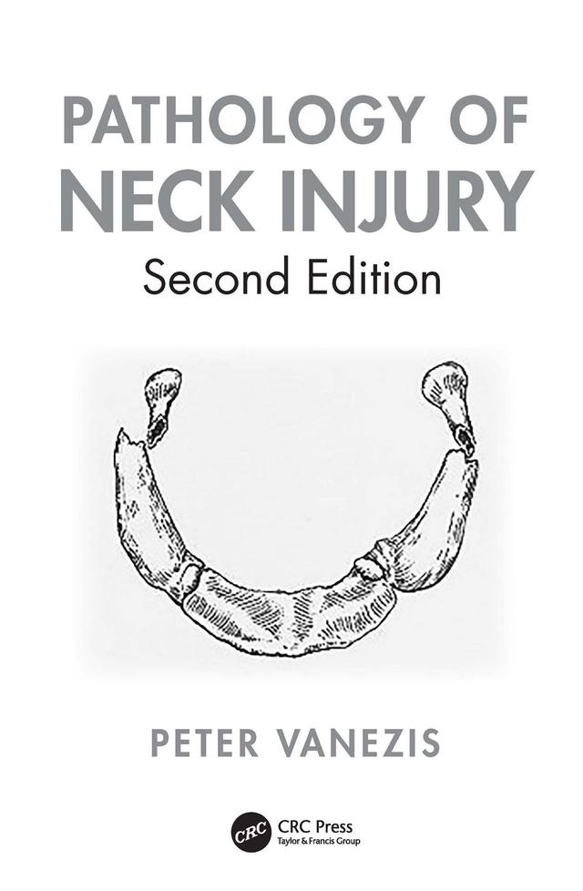 Pathology of Neck Injury by Peter Vanezis