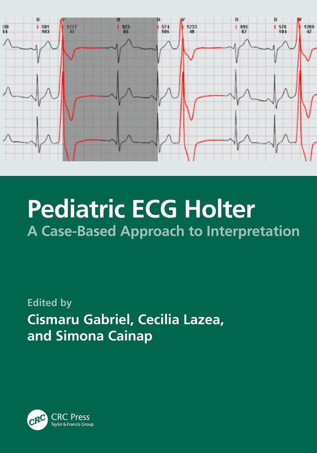Pediatric ECG Holter by Cecilia Lazea, Cismaru Gabriel, Simona Cainap