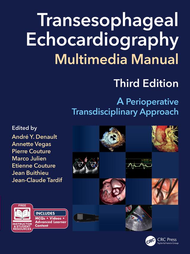 Transesophageal Echocardiography Multimedia Manual by André Denault MD PhD, Annette Vegas, Etienne Couture, Jean Buithieu, Jean-Claude Tardif, Marco Julien, Pierre Couture