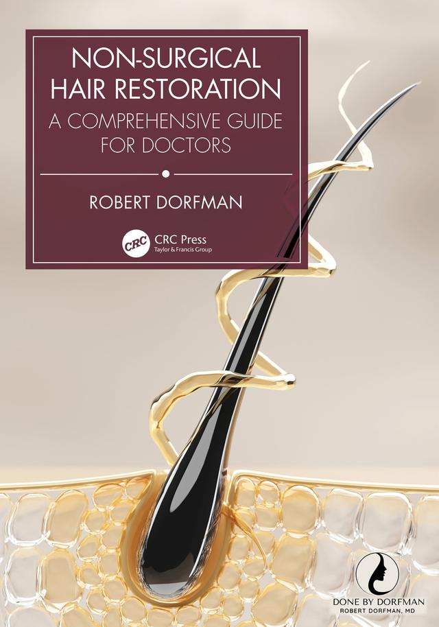 Non-Surgical Hair Restoration by Robert Dorfman