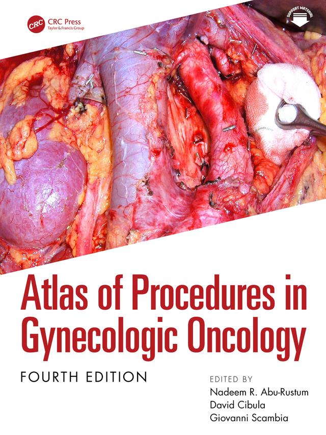 Atlas of Procedures in Gynecologic Oncology by David Cibula, Giovanni Scambia, Nadeem R. Abu-Rustum