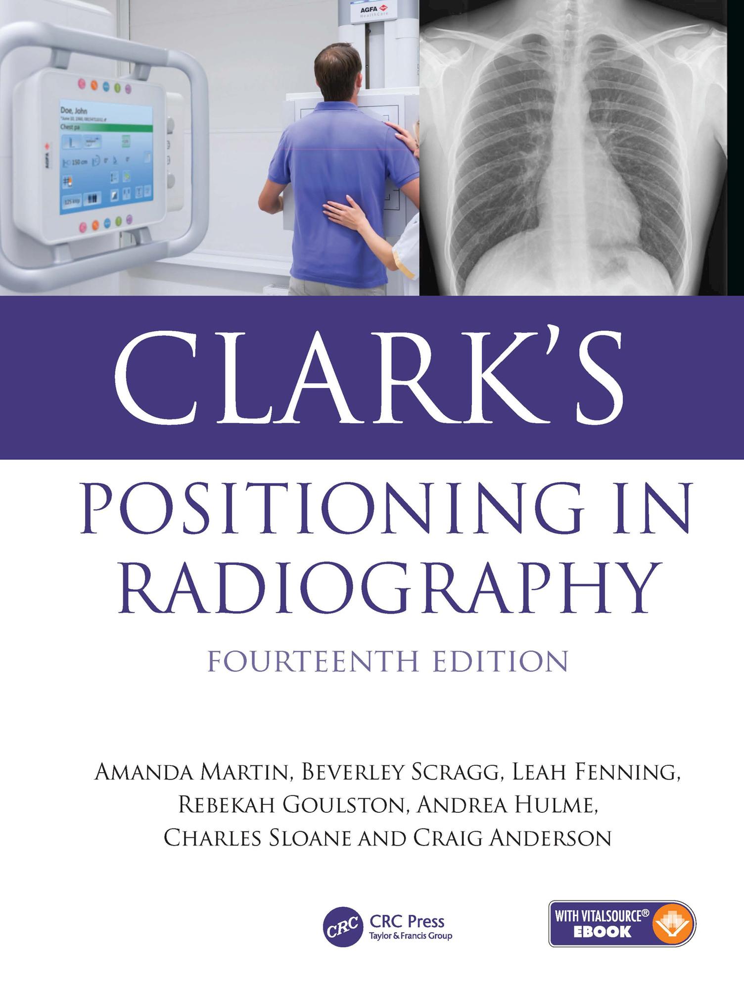 Clark's Positioning in Radiography
