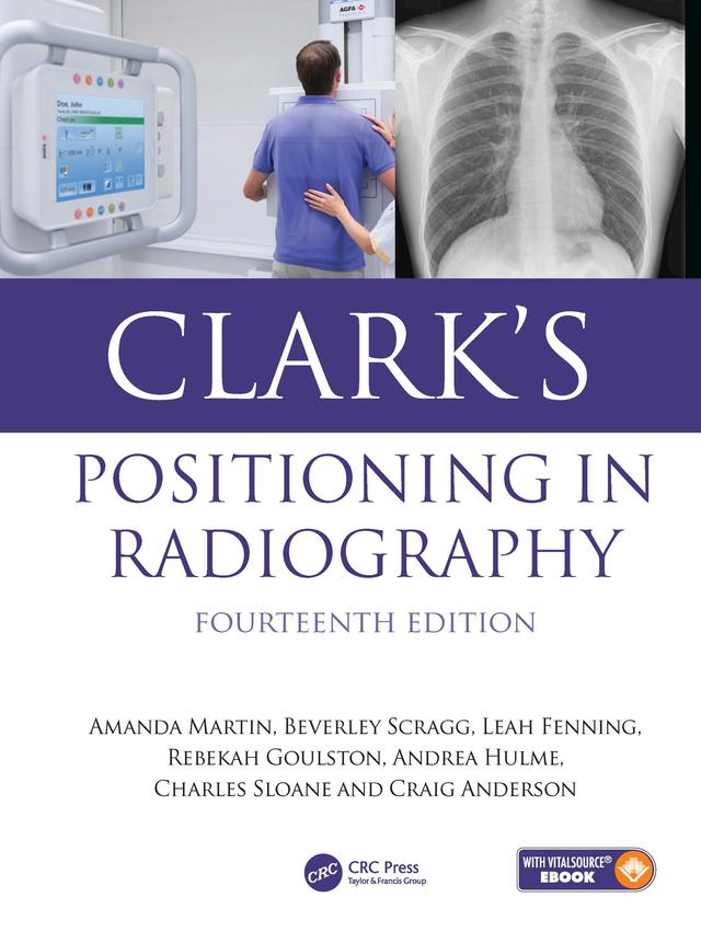 Clark's Positioning in Radiography by Amanda Martin, Andrea Hulme, Beverley Scragg, Charles Sloane, Craig Anderson, Leah Fenning, Rebekah Goulston, Ruth Eaves