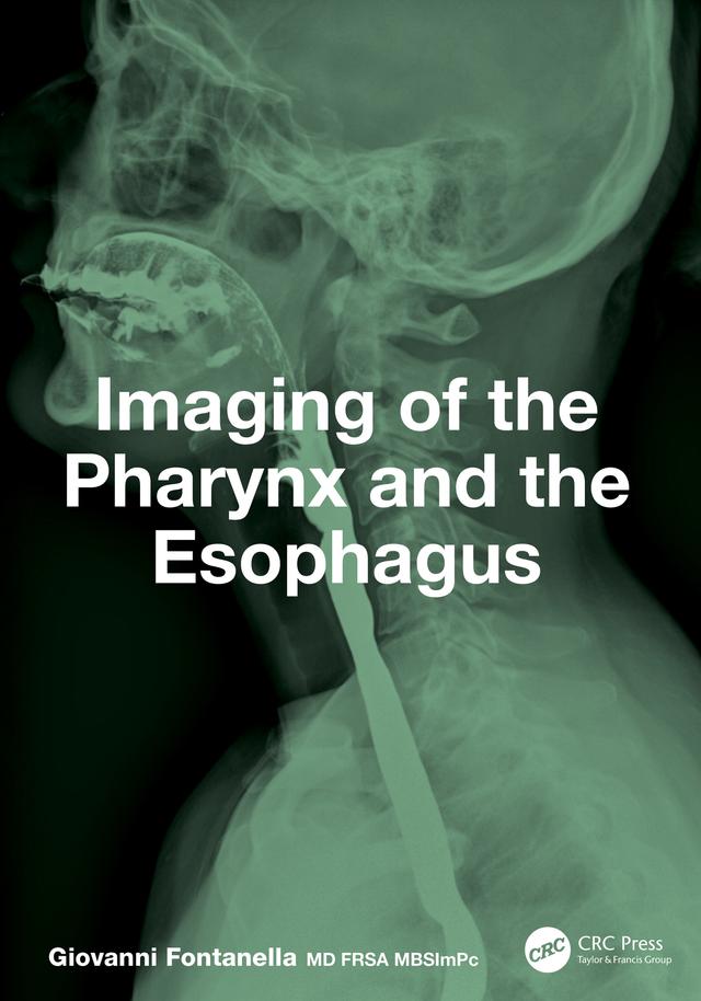 Imaging of the Pharynx and the Esophagus by Giovanni Fontanella
