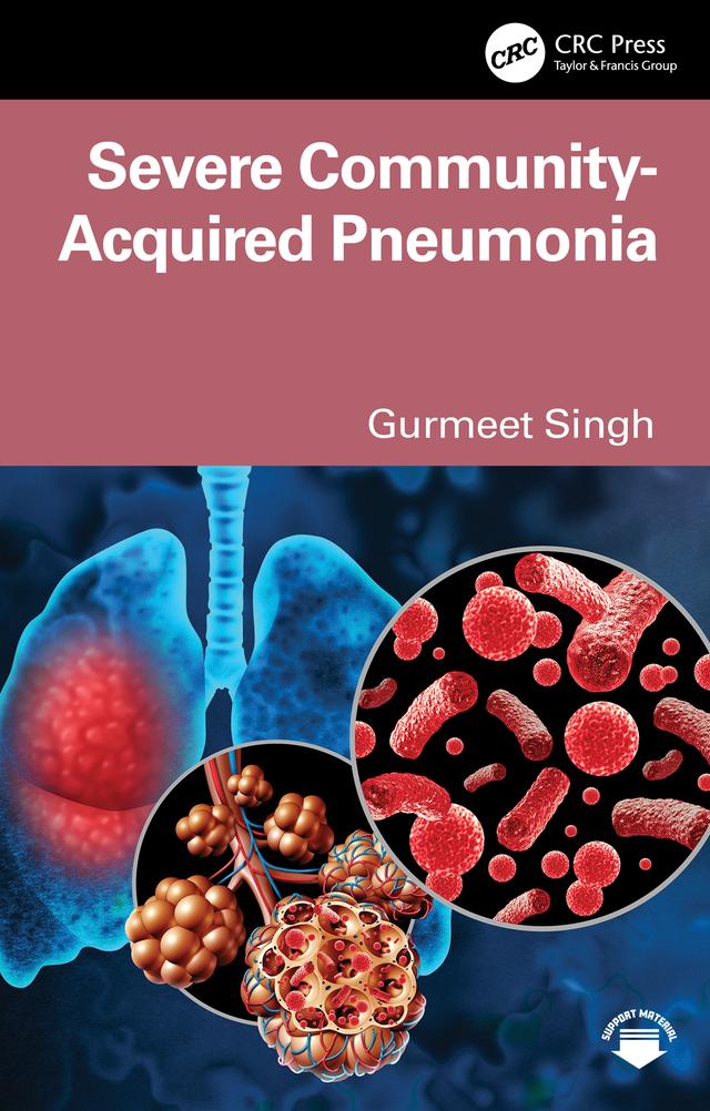Severe Community-Acquired Pneumonia by Gurmeet Singh