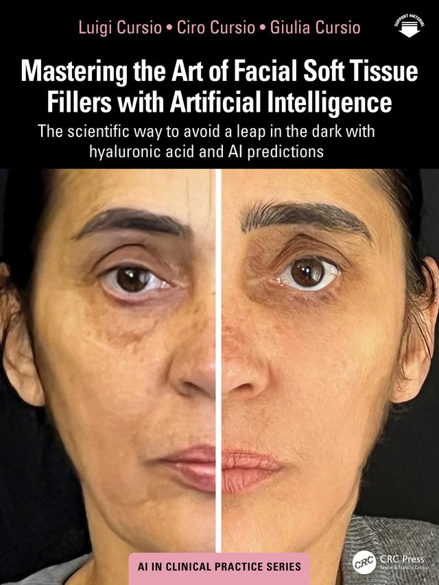Mastering the Art of Facial Soft Tissue Fillers with Artificial Intelligence by Ciro Cursio, Giulia Cursio, Luigi Cursio