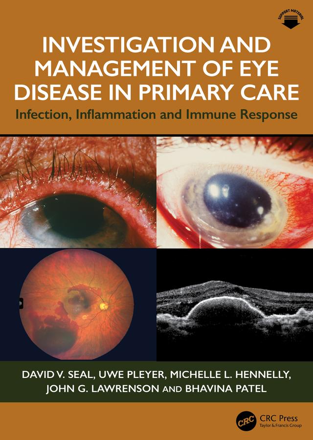 Investigation & Management of Eye Disease in Primary Care by Bhavina Patel, David V. Seal, John G. Lawrenson, Michelle L. Hennelly, Uwe Pleyer