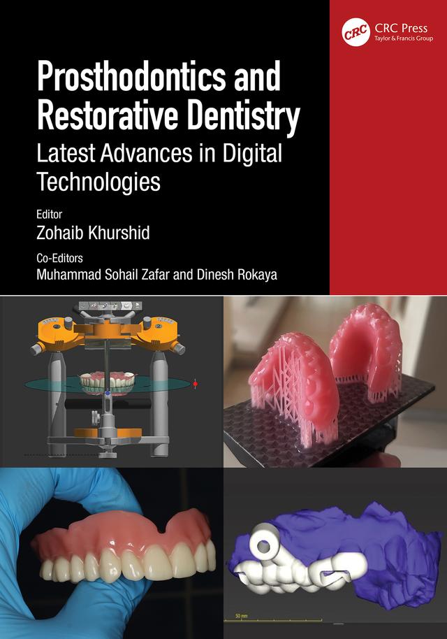 Prosthodontics and Restorative Dentistry by Dinesh Rokaya, Muhammad Sohail Zafar, Zohaib Khurshid
