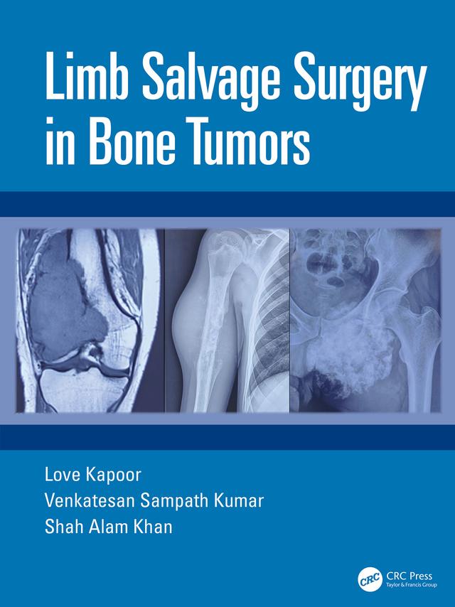 Limb Salvage Surgery in Bone Tumors by Love Kapoor, Shah Alam Khan, Venkatesan Sampath Kumar