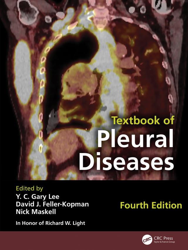 Textbook of Pleural Diseases by David J. Feller- Kopman, Nick Maskell, Richard W. Light, Y C Gary Lee