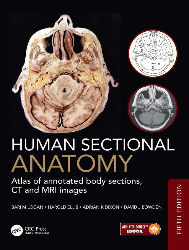 Human Sectional Anatomy by Adrian K Dixon, Bari M Logan, David J Bowden, Harold Ellis