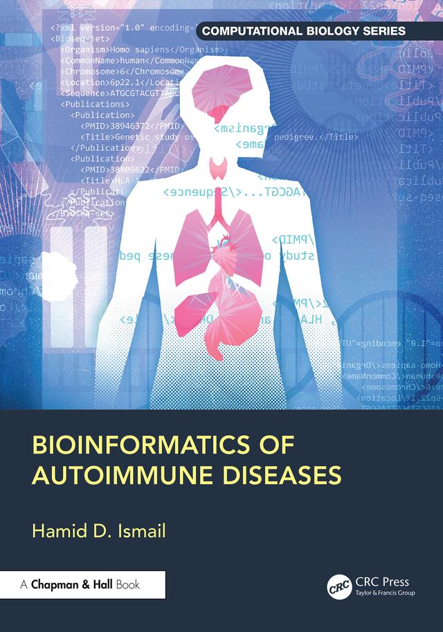 Bioinformatics of Autoimmune Diseases by Hamid D. Ismail