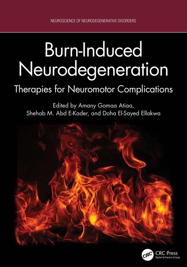 Burn-Induced Neurodegeneration by Amany Gomaa Atiaa, Shehab M. Abd E-Kader