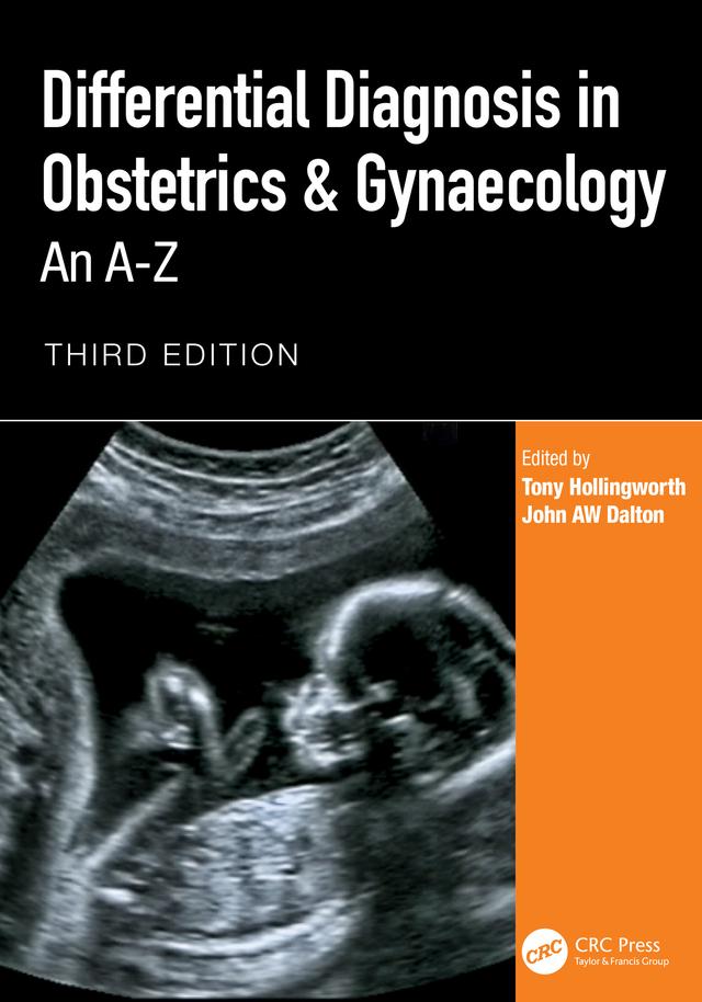 Differential Diagnosis in Obstetrics & Gynaecology by John AW Dalton, Tony Hollingworth