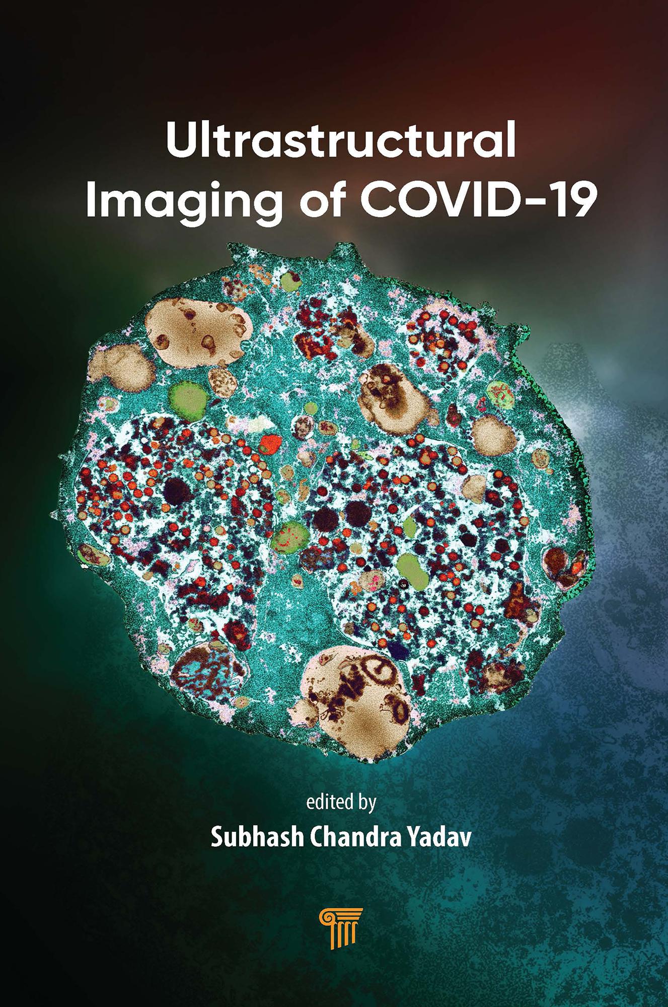 Ultrastructural Imaging of COVID-19