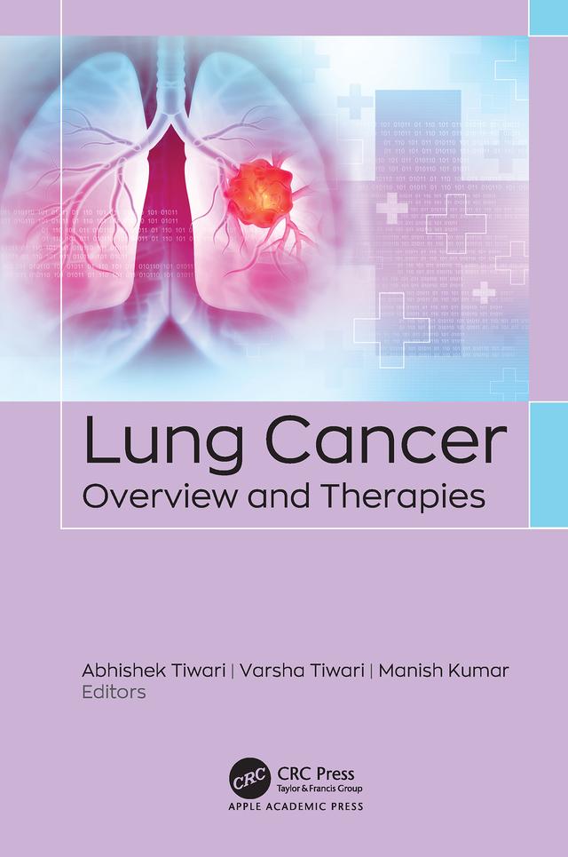 Lung Cancer by Abhishek Tiwari, Manish Kumar, Varsha Tiwari