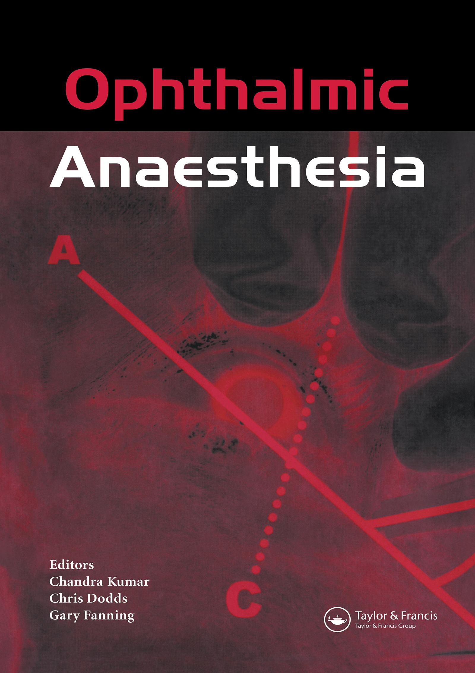 Ophthalmic Anaesthesia
