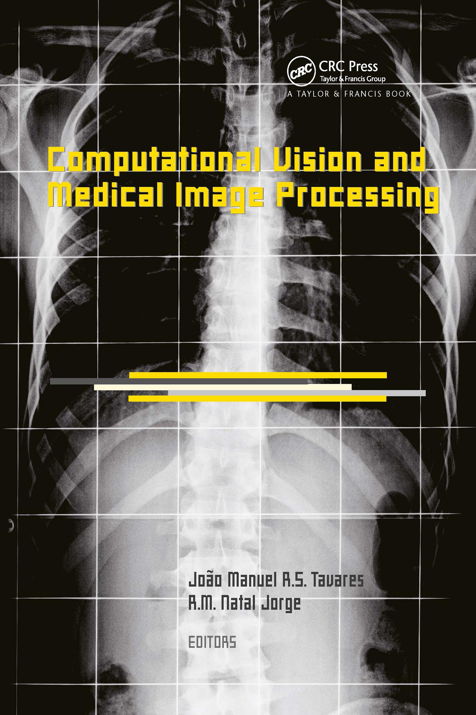 Computational Vision and Medical Image Processing