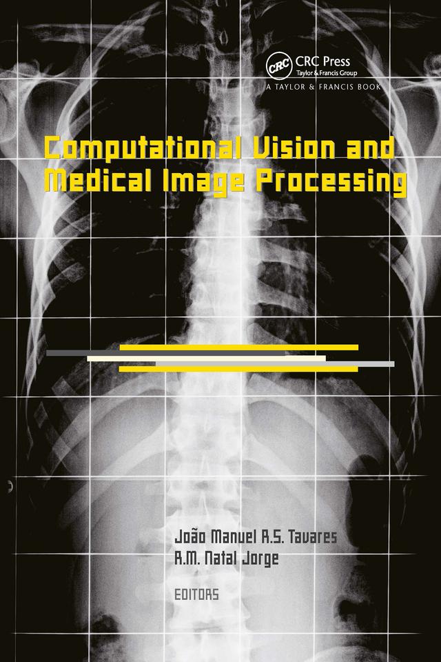 Computational Vision and Medical Image Processing by João Manuel R.S. Tavares, R.M. Natal Jorge