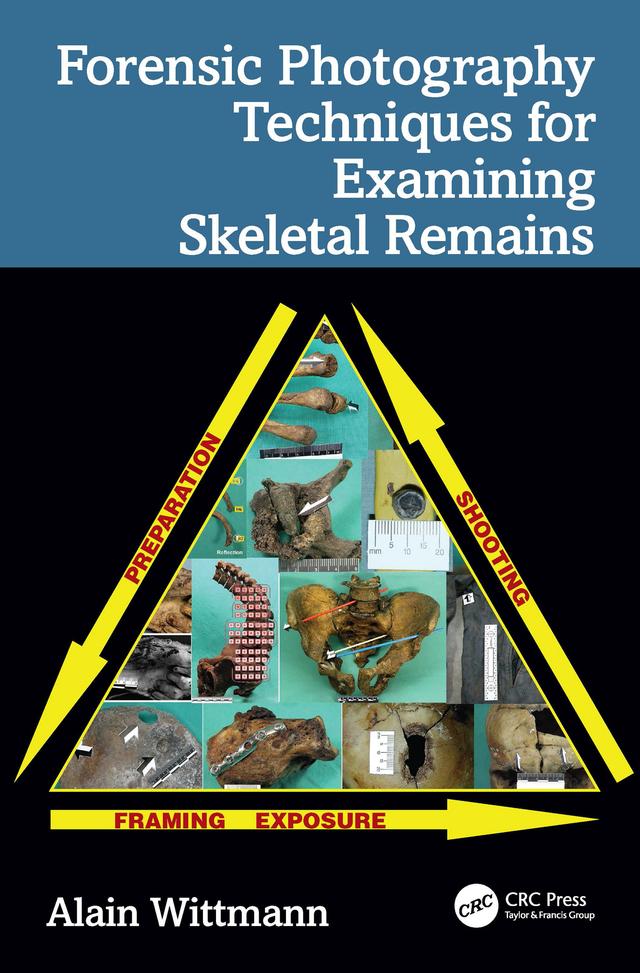 Forensic Photography Techniques for Examining Skeletal Remains by Alain Wittmann