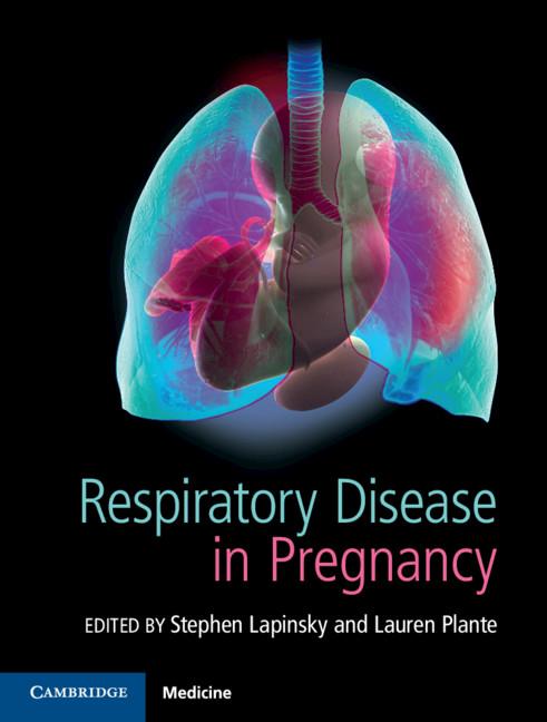 Respiratory Disease in Pregnancy by Lauren A. Plante, Stephen E. Lapinsky