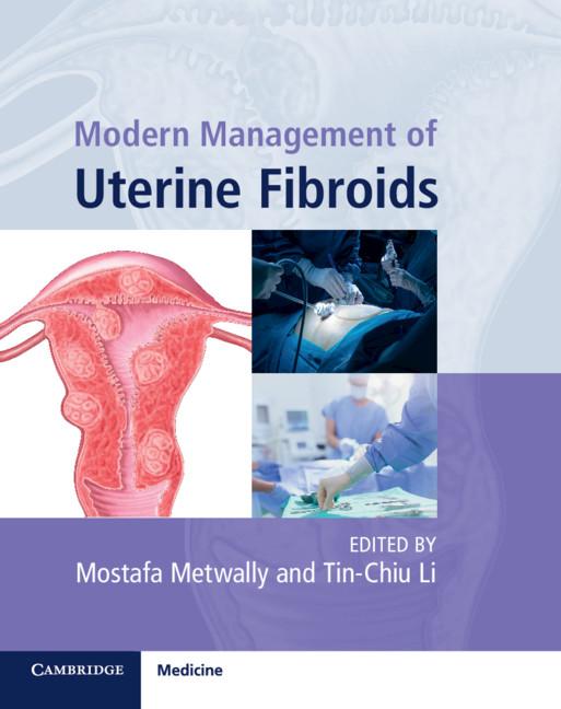 Modern Management of Uterine Fibroids by Mostafa Metwally, Tin-Chiu Li