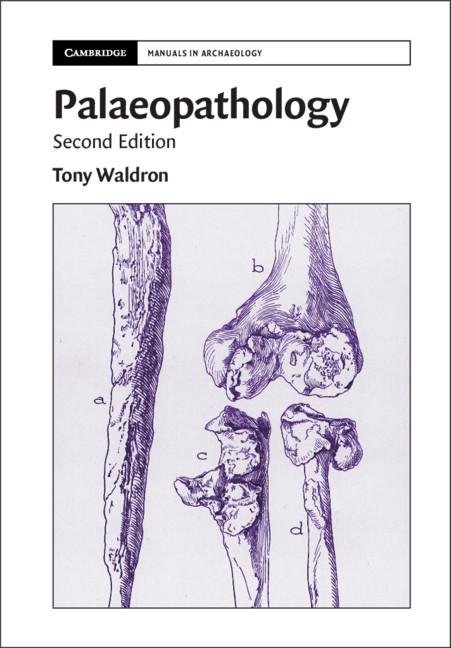 Palaeopathology by Tony Waldron