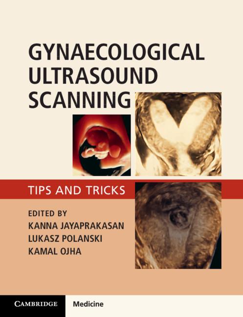 Gynaecological Ultrasound Scanning by Kamal Ojha, Kanna Jayaprakasan, Lukasz Polanski