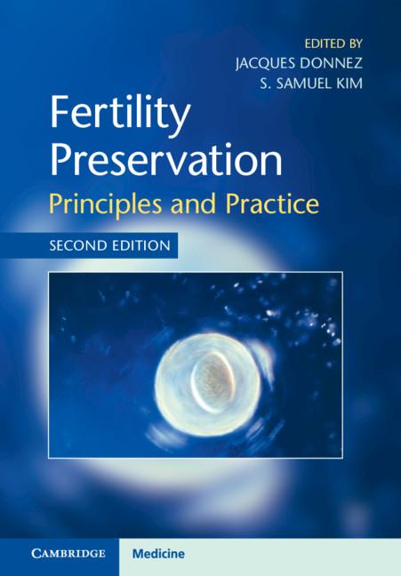 Fertility Preservation by Jacques Donnez, S. Samuel Kim
