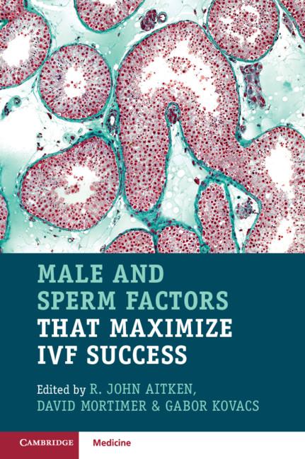 Male and Sperm Factors that Maximize IVF Success by David Mortimer, Gabor Kovacs, R. John Aitken