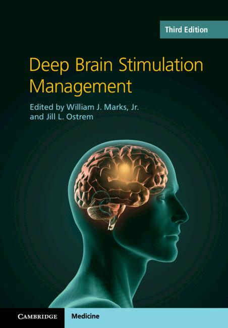 Deep Brain Stimulation Management by Jill L. Ostrem, William J. Marks