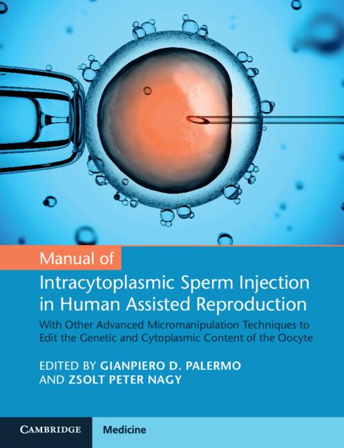 Manual of Intracytoplasmic Sperm Injection in Human Assisted Reproduction by Gianpiero D. Palermo, Zsolt Peter Nagy