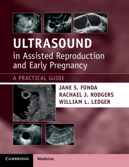 Ultrasound in Assisted Reproduction and Early Pregnancy by Jane S. Fonda, Rachael J. Rodgers, William L. Ledger