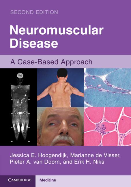 Neuromuscular Disease by Erik H. Niks, Jessica E. Hoogendijk, Marianne de Visser, Pieter A. van Doorn