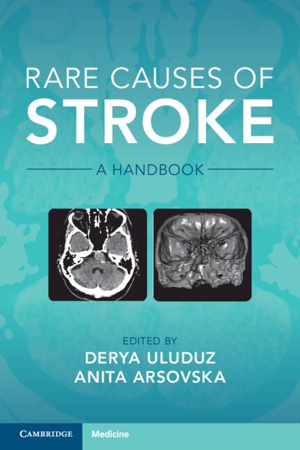 Rare Causes of Stroke by Anita Arsovska, Derya Uluduz