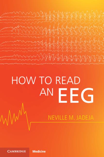 How to Read an EEG by Neville M. Jadeja