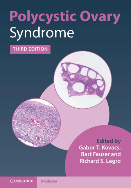 Polycystic Ovary Syndrome by Bart Fauser, Gabor T. Kovacs, Richard S. Legro