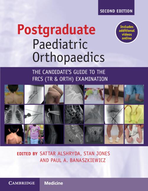 Postgraduate Paediatric Orthopaedics by Paul A. Banaszkiewicz, Sattar Alshryda, Stan Jones