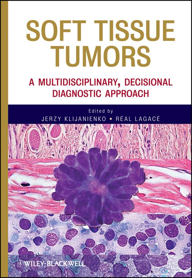 Soft Tissue Tumors by Jerzy Klijanienko, Real Lagace
