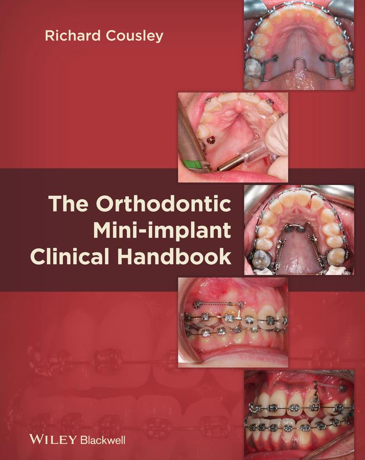 The Orthodontic Mini-implant Clinical Handbook