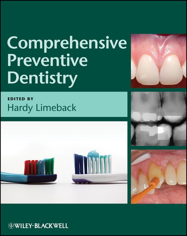 Comprehensive Preventive Dentistry by Hardy Limeback