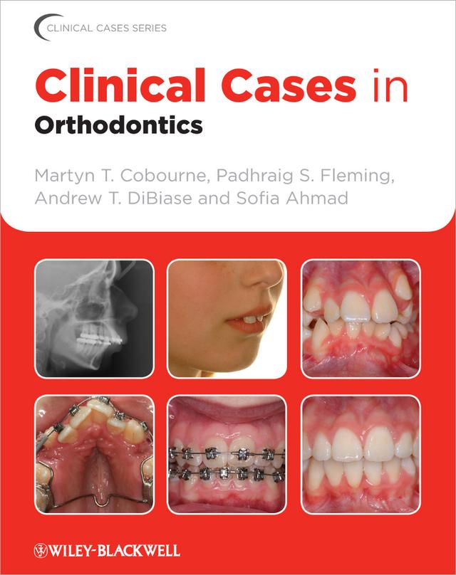 Clinical Cases in Orthodontics by Andrew T. DiBiase, Martyn T. Cobourne, Padhraig S. Fleming, Sofia Ahmad