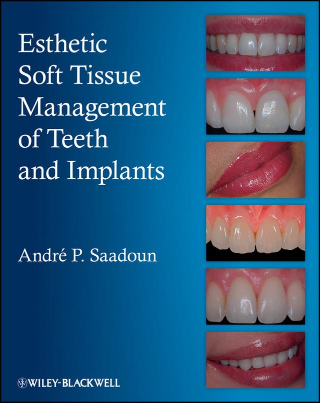Esthetic Soft Tissue Management of Teeth and Implants by Andre P. Saadoun