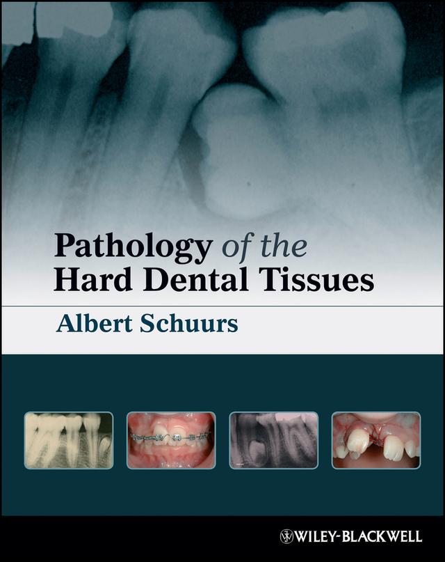 Pathology of the Hard Dental Tissues by Albert Schuurs
