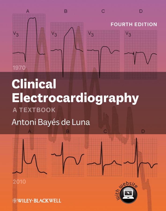 Clinical Electrocardiography